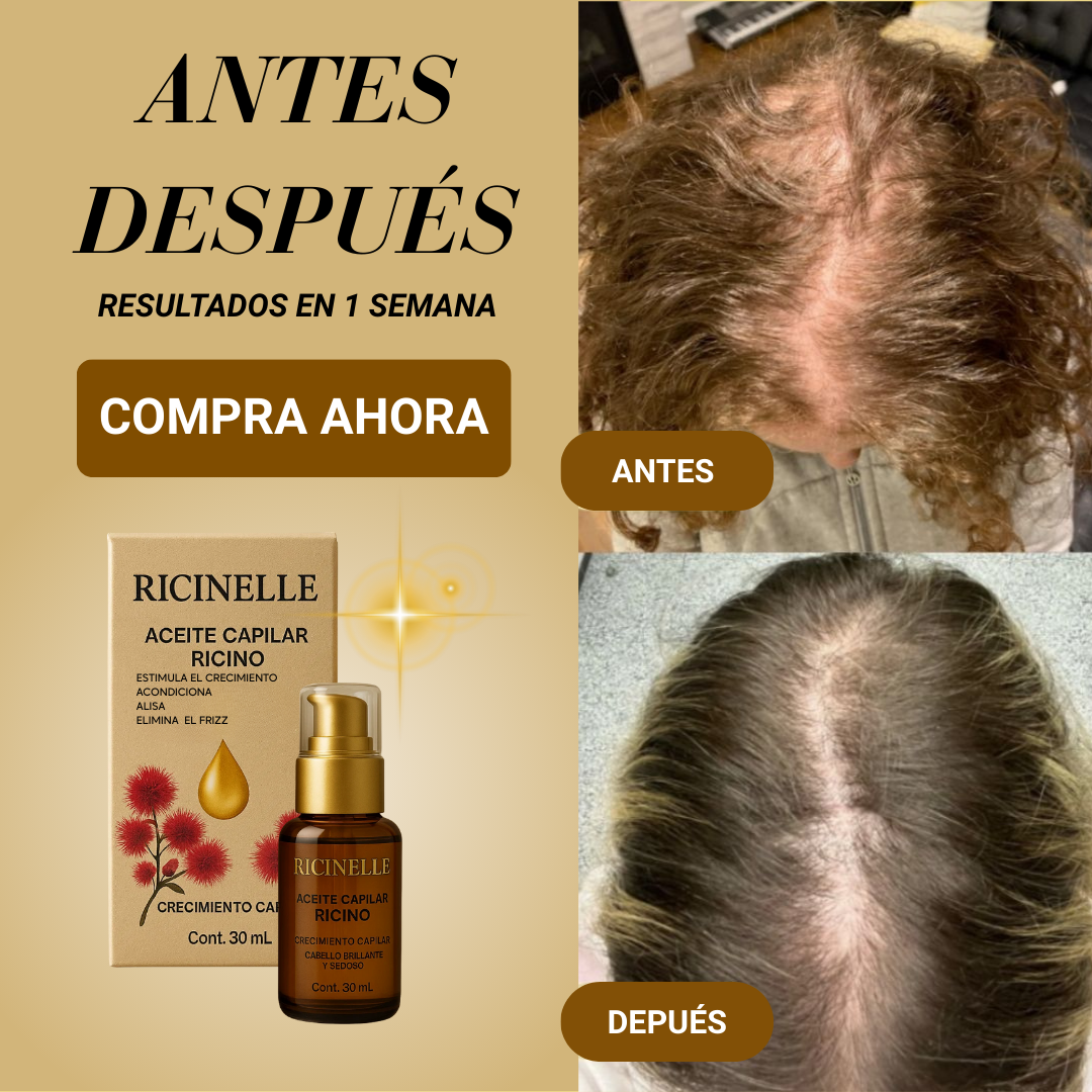 Ricinelle ™️| Nutrición Profunda Para un Crecimiento Visible