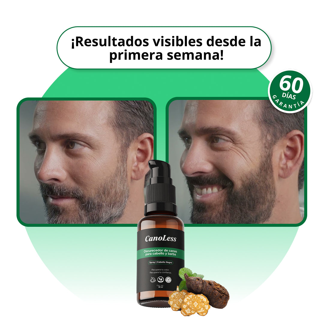 CanoLess™ | Dile adiós a tus canas