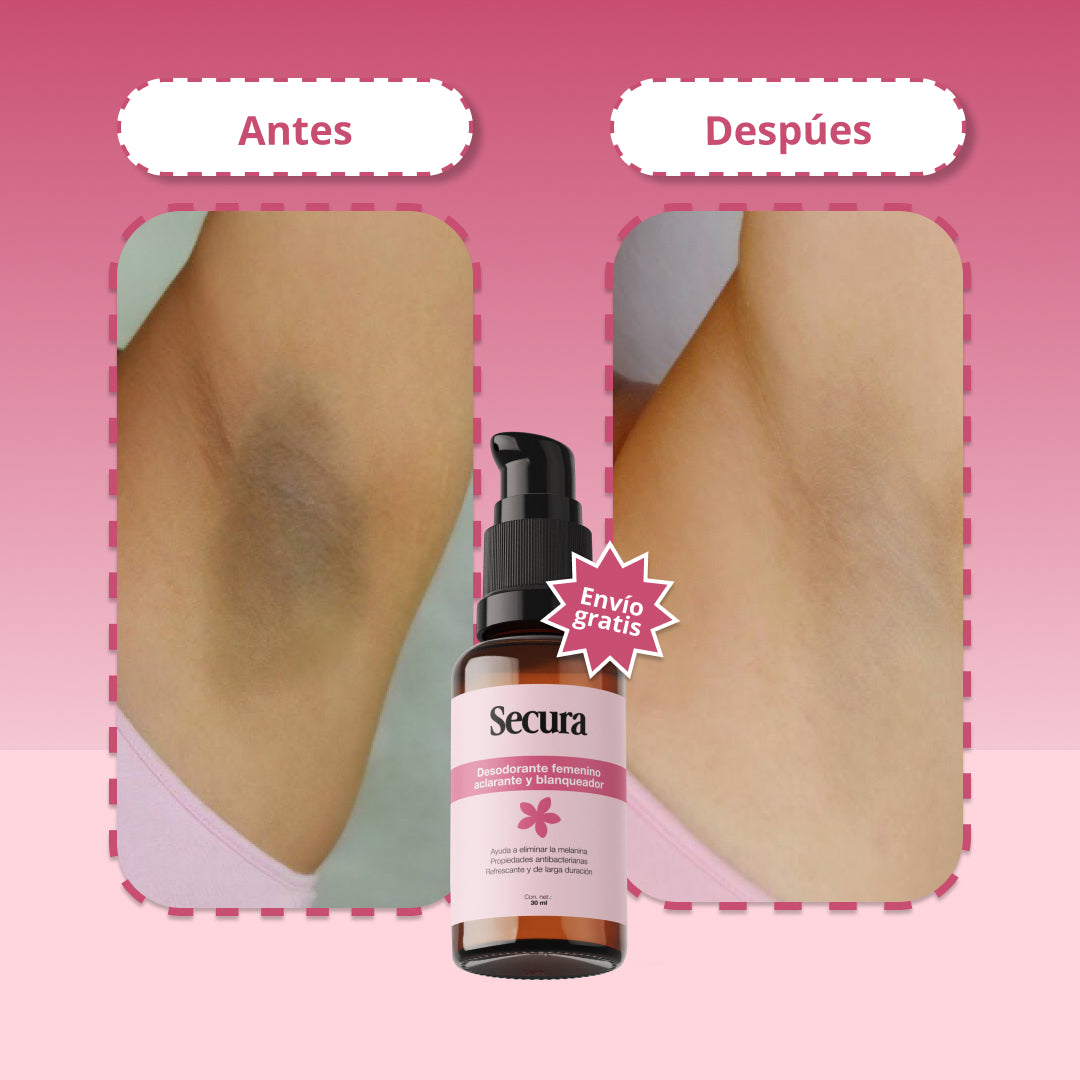 Secura™ | Dile adiós a las Manchas y Malos olores